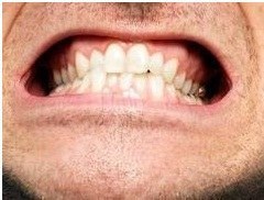 Mouth, Teeth